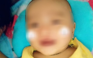 Vụ trẻ 4 tháng tuổi tử vong: Bộ Y tế yêu cầu Sơn La xác minh, công khai kết quả
