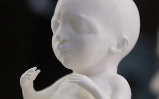 Công nghệ in 3D giúp bố mẹ có được mô hình của thai nhi