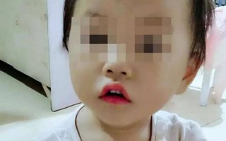 Ăn chậm, bé gái 5 tuổi bị bố mẹ đánh trọng thương