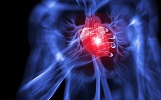 Diễn tiến âm thầm nguy hiểm của bệnh nhồi máu cơ tim 
