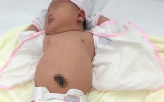TP.HCM: Bệnh viện Quận 11 đón bé gái chào đời nặng 5,2kg
