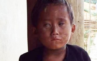 Xin cứu lấy đôi mắt của cậu bé người Mông
