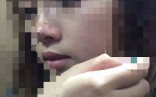 Thông tin mới nhất vụ cô gái bị cưỡng hôn trong thang máy ở Hà Nội