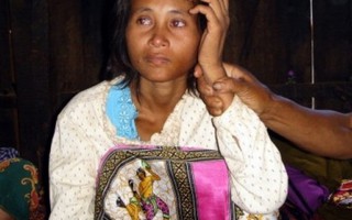 'Cô gái người rừng' đoàn tụ với gia đình Việt sau 10 năm lưu lạc