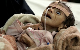 Yemen: 2,9 triệu phụ nữ và trẻ em đang sống dở chết dở vì đói