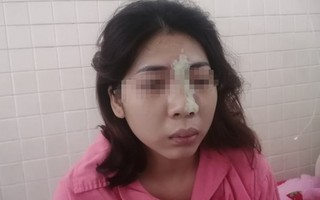 Mù mắt sau khi tiêm filler nâng mũi tại spa