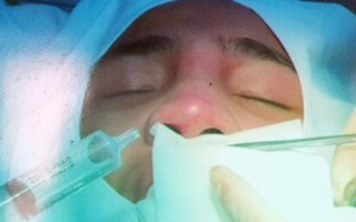 Tiêm filler tại spa, cô gái 28 tuổi suýt mất mũi