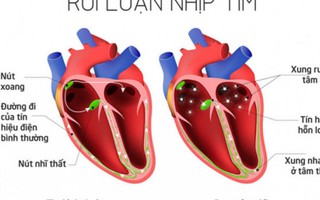 Tác hại khó lường của việc ăn no dưa hấu