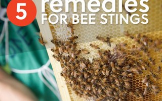 5 cách hiệu quả để trị ong đốt