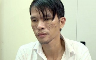 Bộ Công an muốn Campuchia giám định thương tật bé trai bị bạo hành