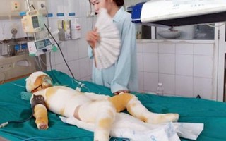Vụ 3 trẻ mầm non bị bỏng: Bộ Giáo dục yêu cầu làm rõ