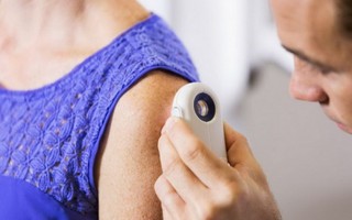 Các nhà khoa học Australia đã ngăn chặn được ung thư da 