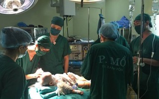 BV Xanh Pôn tạo hình hộp sọ cho bé 11 tháng tuổi