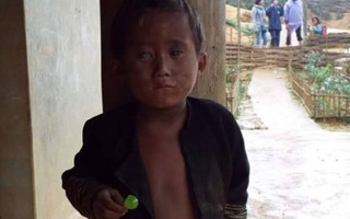 Cậu bé người Mông có nguy cơ hỏng cả 2 mắt 