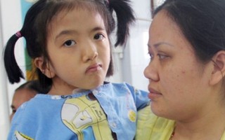 Giúp đỡ bé gái bị đa khuyết tật