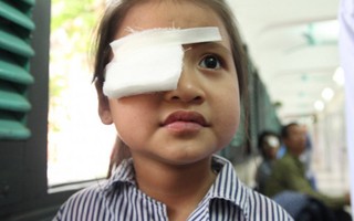 Ngã vào bụi tre, bé 5 tuổi bị gai đâm rách mắt