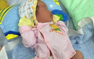 Vụ trẻ bị gãy chân khi mổ sinh: Bộ Y tế yêu cầu làm rõ 