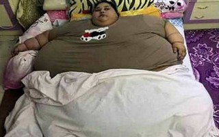 Ấn tượng thành tích giảm cân của người phụ nữ béo nhất thế giới