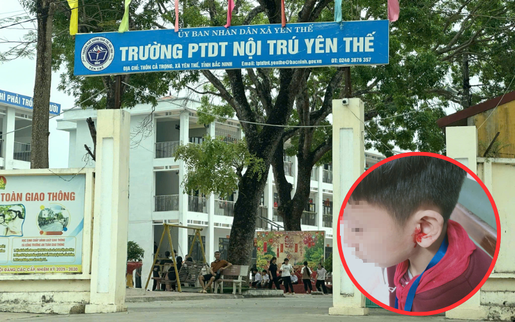 Bắc Ninh: Học sinh bị thầy giáo véo tai đến chảy máu
